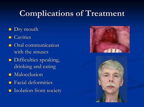 Oral Complications of Cancer and its Management (2010-02-25)